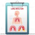 Lung Infection 101: Types, Causes, Symptoms and Treatments